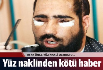 10 ay önce yüz nakli olan Salih Üslün yaşamını yitirdi