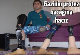 Gazinin protez bacağına haciz geldi