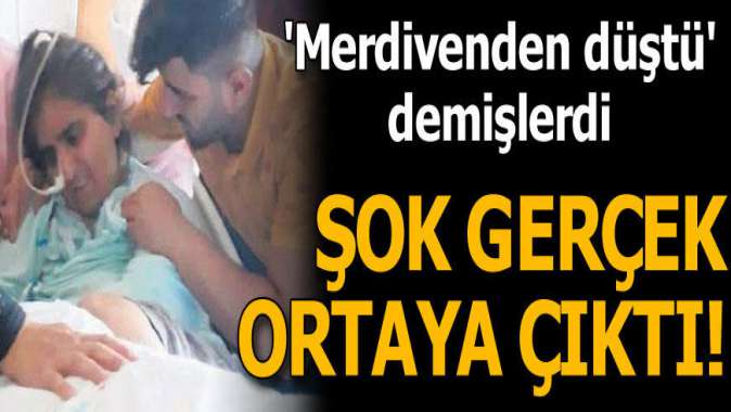 Merdivenden düştü dediler! Şok gerçek ortaya çıktı