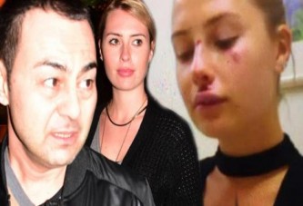 Serdar Ortaç’ın eşi Chloe bu hale geldi