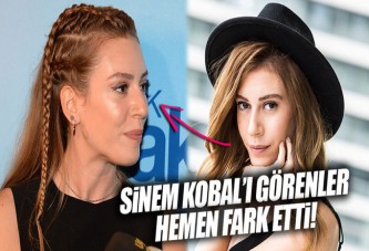 Sinem Kobal bıçak altına yattı