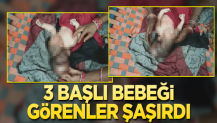 3 başlı bebeği görenler hayret etti