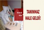 Boşanmak isteyince tanınmaz hale geldi!