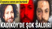 Kadıköy'de oyuncuya şok saldırı! Canını zor kurtardı