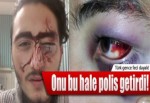 Onu bu hale polis getirdi!