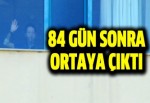 Yüz naklinden 84 gün sonra odasından çıktı