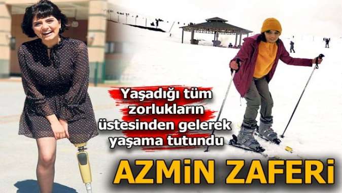 Yaşama azmiyle herkese örnek oldu